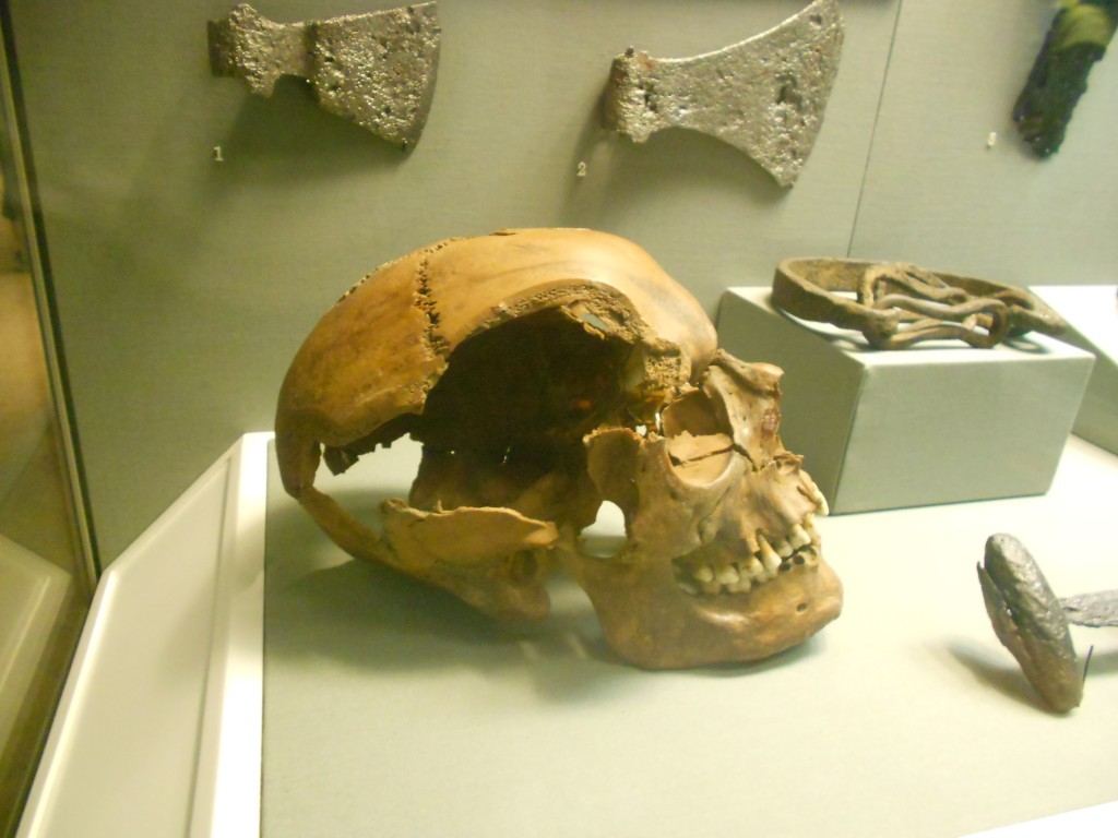 Skull in the National Museum of Archaeology and History